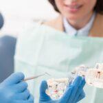 Pourquoi les inlays sont une solution thérapeutique moins invasive que les couronnes