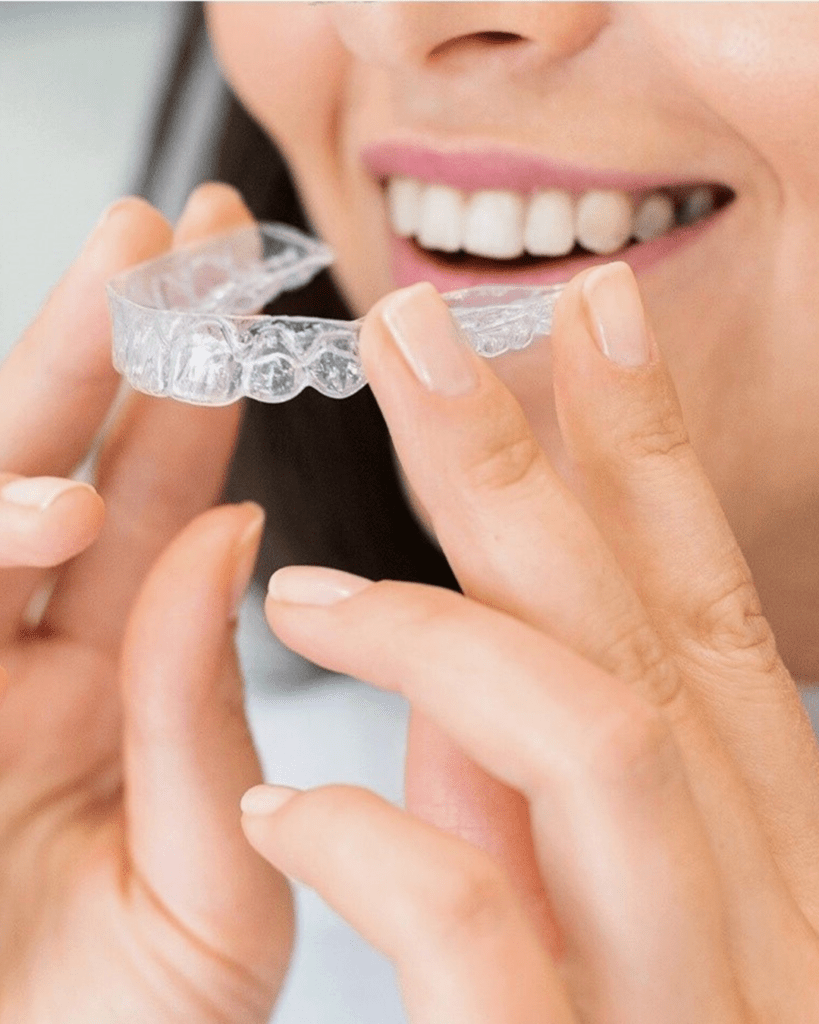 pose d'appareil dentaire invisible